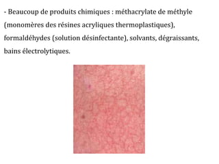 - Beaucoup de produits chimiques : méthacrylate de méthyle
(monomères des résines acryliques thermoplastiques),
formaldéhydes (solution désinfectante), solvants, dégraissants,
bains électrolytiques.
 