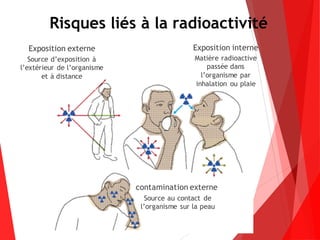 Risques liés à la radioactivité
Exposition externe
Source d’exposition à
l’extérieur de l’organisme
et à distance
contamination externe
Matière radioactive
passée dans
l’organisme par
inhalation ou plaie
Exposition interne
Source au contact de
l’organisme sur la peau
 