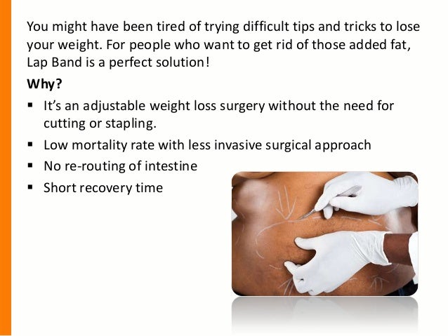 Less invasive weight loss procedure Lap band surgery in