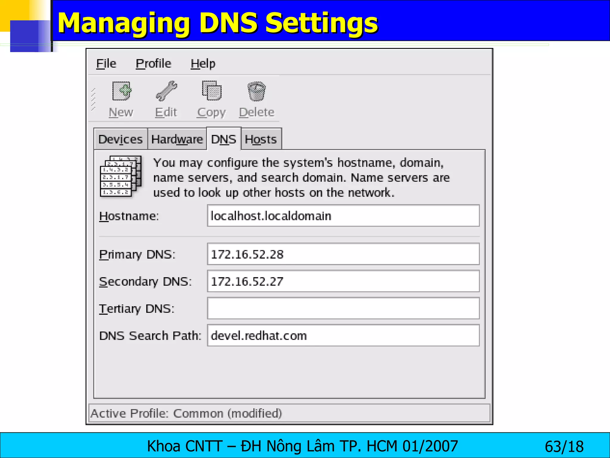Managing DNS Settings  