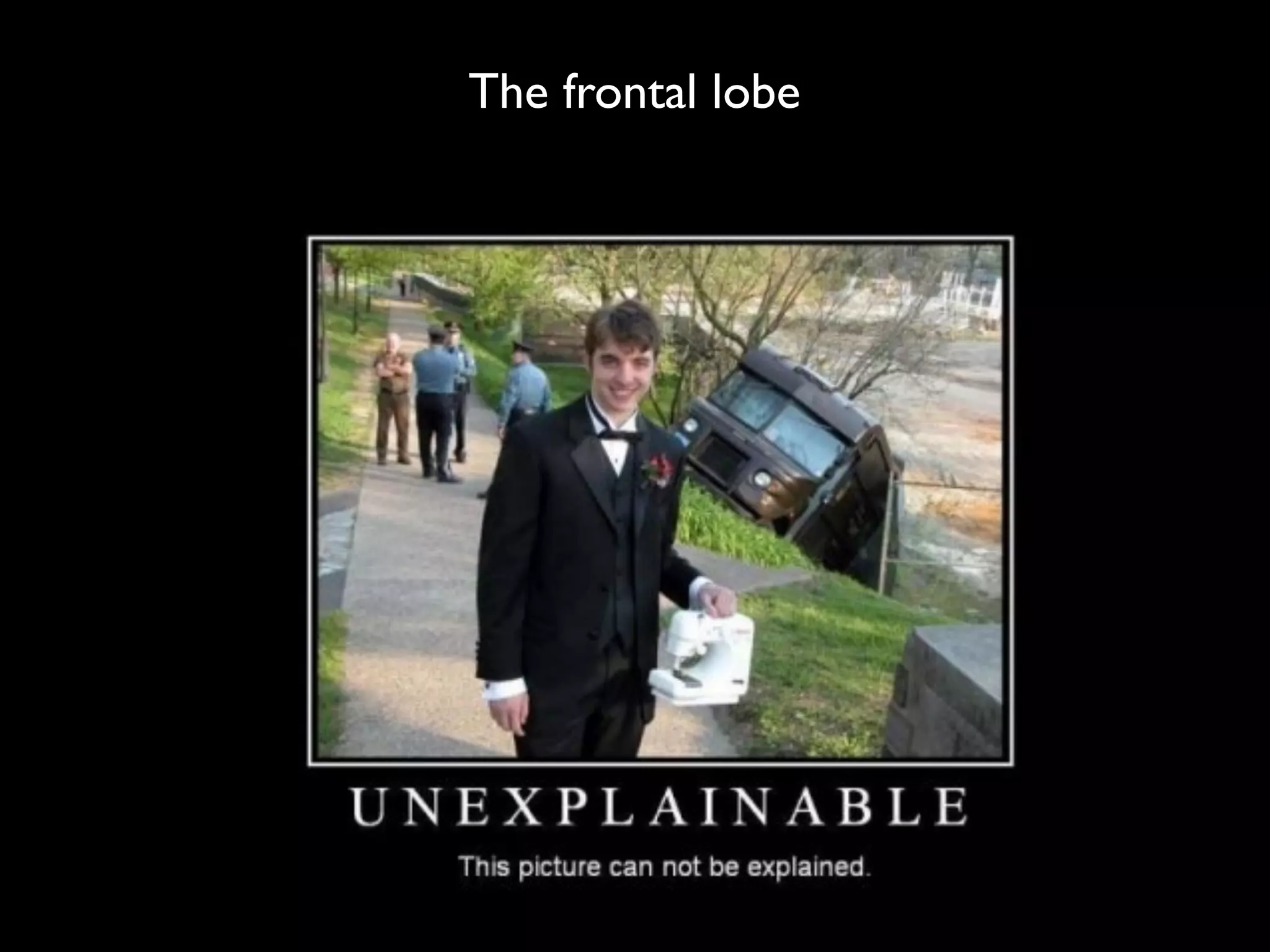 The frontal lobe
 