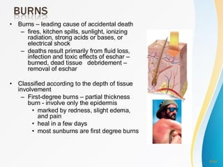 Lesson-4.-Integumentary-System (1).pdfsd | PDF