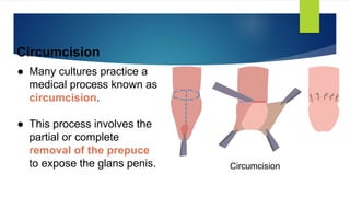 Circumincession Process lesson 1.1 grade10 male reproductive 3rd quarter..pptx