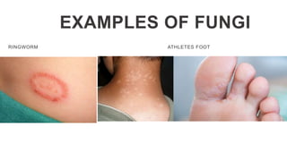 EXAMPLES OF FUNGI
RINGWORM ATHLETES FOOT
 