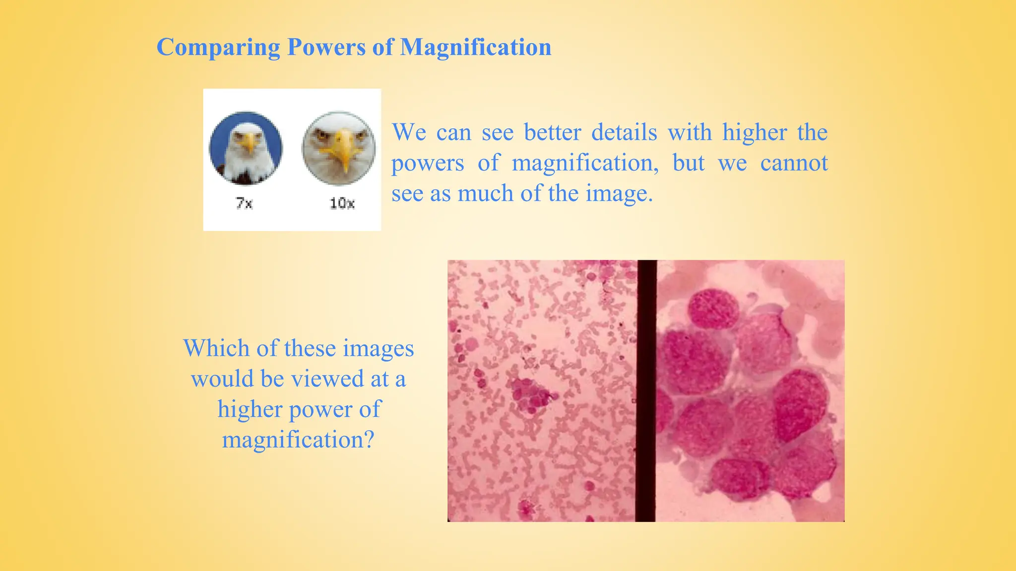 Comparing Powers of Magnification
We can see better details with higher the
powers of magnification, but we cannot
see as much of the image.
Which of these images
would be viewed at a
higher power of
magnification?
 