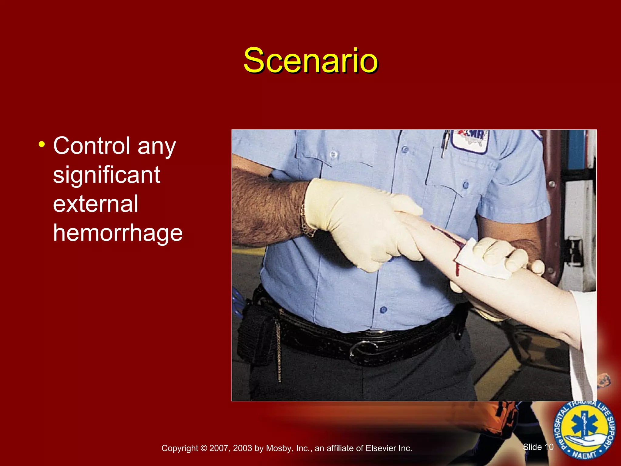 Scenario Control any significant  external hemorrhage 