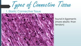 Types of Connective Tissue
1. Elastic Connective Tissue
found in ligaments
(more elastic than
tendon)
 