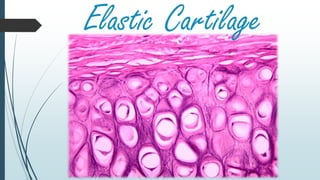 Elastic Cartilage
 