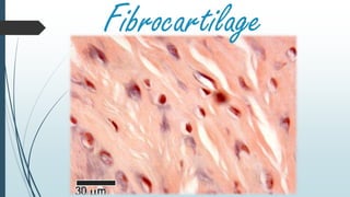 Fibrocartilage
 