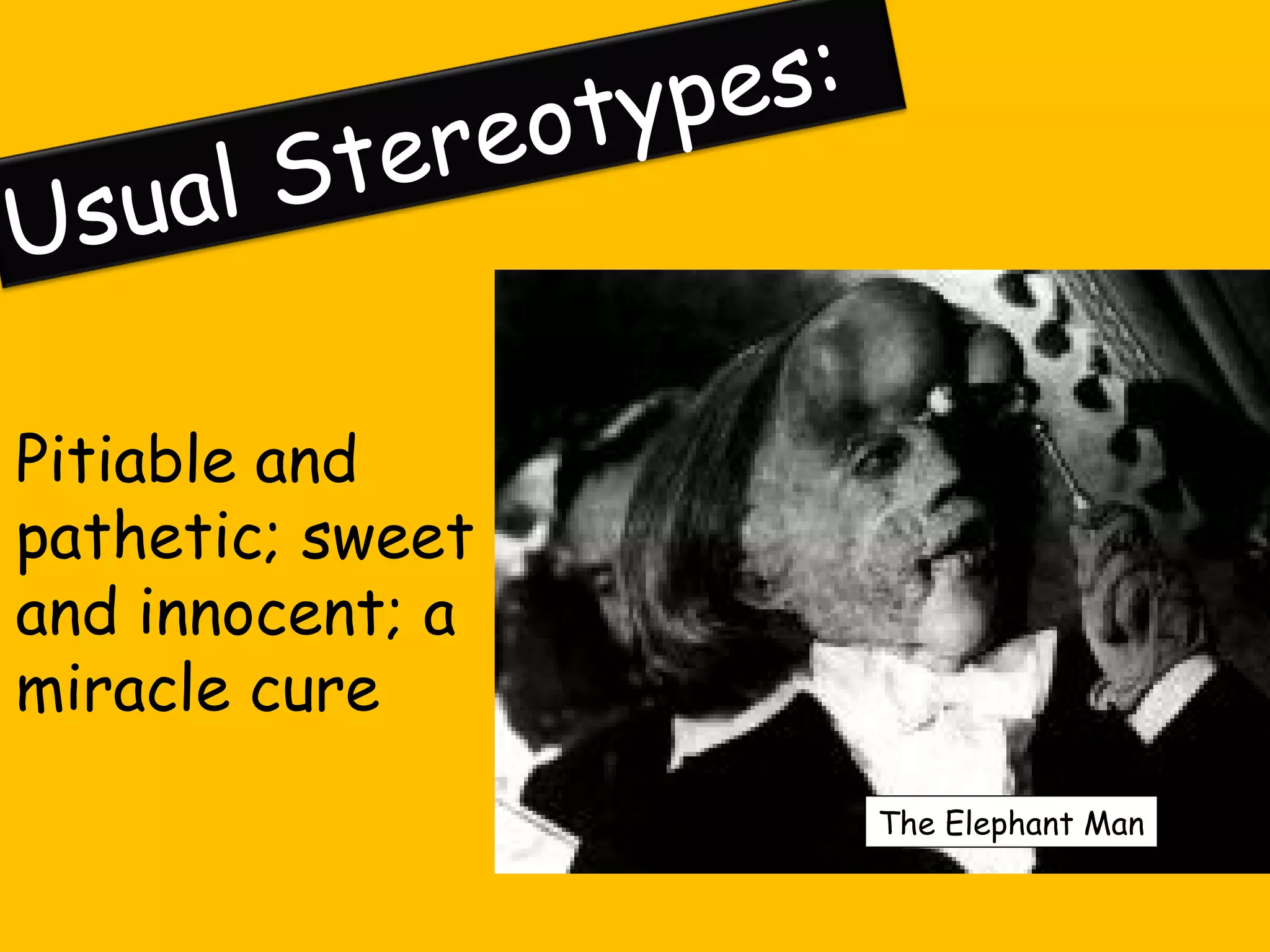 e re
l St
sua
U

es :
typ
o

Pitiable and
pathetic; sweet
and innocent; a
miracle cure
The Elephant Man

 