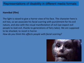 Representations of disability in different media formats 
Hannibal (film) 
The light is raised to give a horror view of his face. The character here is 
evil too, so we associate his facial scarring with punishment for his evil 
nature, and also with the visual manifestation of evil (we expect evil 
people to look evil, thanks to generations of fairy tales). We are supposed 
to be shocked, to recoil in horror. 
How do you think this affects people with facial scarring? 
 