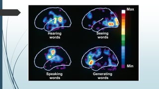 Generating
words
Max
Speaking
words
Hearing
words
Seeing
words
Min
 