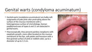 Lesson 18. Pathology of the mucous membrane of the mouth and lips 2.pptx