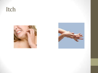 Itch
 