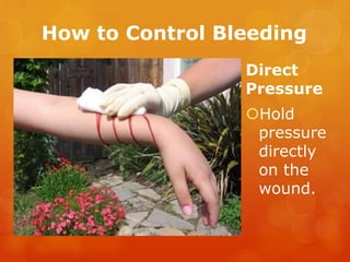 How to Control Bleeding
Direct
Pressure
Hold
pressure
directly
on the
wound.
 