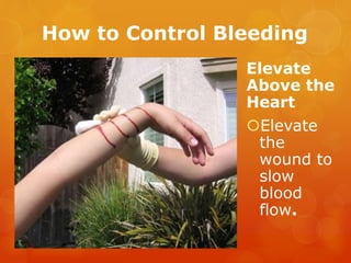 How to Control Bleeding
Elevate
Above the
Heart
Elevate
the
wound to
slow
blood
flow.
 