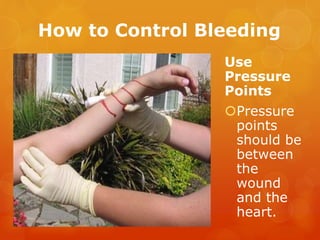 How to Control Bleeding
Use
Pressure
Points
Pressure
points
should be
between
the
wound
and the
heart.
 