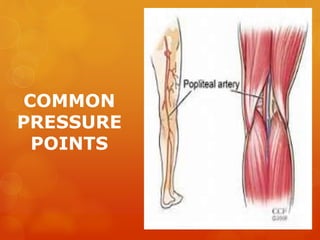 COMMON
PRESSURE
POINTS
 