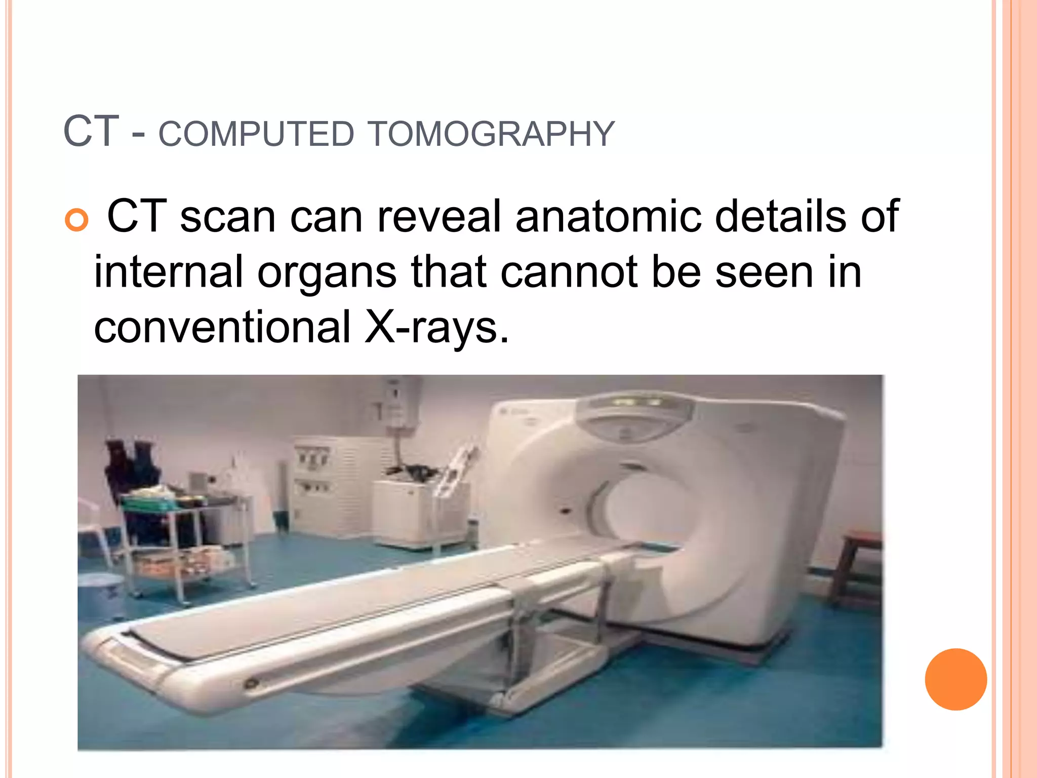 CT - COMPUTED TOMOGRAPHY
 CT scan can reveal anatomic details of
internal organs that cannot be seen in
conventional X-rays.
 