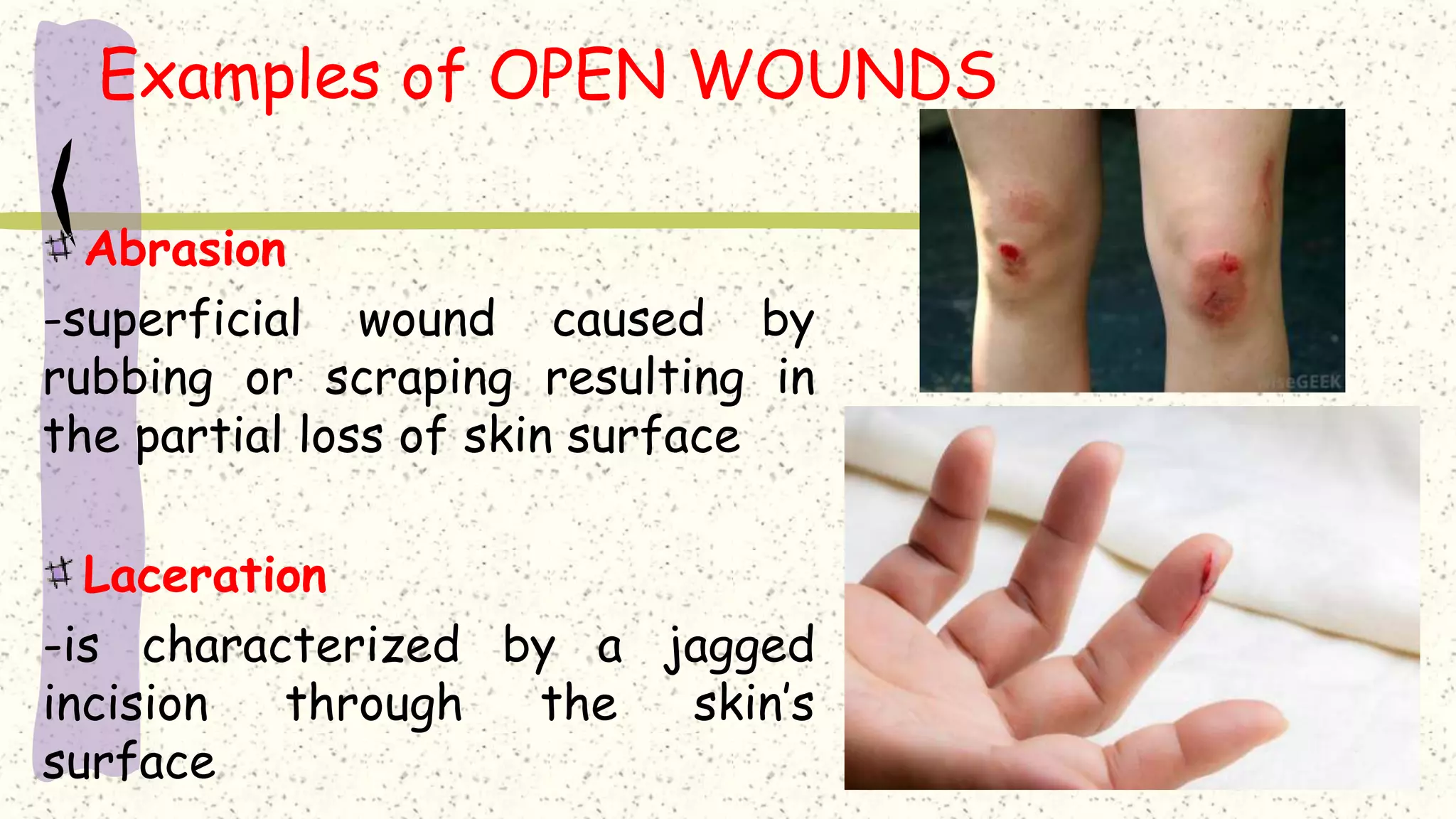 Lesson 1 learning basic first aid | PPTX