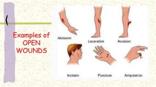 Simple Open Injuries Lesson 1 learning basic first aid | PPTX
