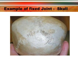 Example of fixed Joint -  Skull 