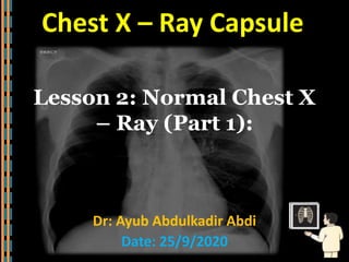 Chest X – Ray Capsule
Lesson 2: Normal Chest X
– Ray (Part 1):
Dr: Ayub Abdulkadir Abdi
Date: 25/9/2020
 