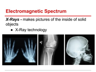 Electromagnetic Spectrum
X-Rays - makes pictures of the inside of solid
objects
● X-Ray technology
 