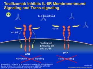 Roche Medical Affairs. All rights reserved.
gp130
gp130
Tocilizumab
binds mIL-6R
and sIL-6R
IL-6 cannot bind
Membrane-bound signaling Trans-signaling
mIL-6R
sIL-6R
Tocilizumab Inhibits IL-6R Membrane-bound
Signaling and Trans-signaling
Adapted from: Jones SA, et al. J Interferon Cytokine Res. 2005;25:241-253.
Scheller J, Rose-John S. Med Microbiol Immunol. 2006;195(4):173-183.
Mihara M. Int Immunopharmacol. 2005 Nov;5(12):1731-40.
P-MOA-ND-004
 