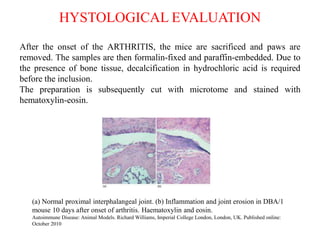 After the onset of the ARTHRITIS, the mice are sacrificed and paws are
removed. The samples are then formalin-fixed and paraffin-embedded. Due to
the presence of bone tissue, decalcification in hydrochloric acid is required
before the inclusion.
The preparation is subsequently cut with microtome and stained with
hematoxylin-eosin.
HYSTOLOGICAL EVALUATION
(a) Normal proximal interphalangeal joint. (b) Inflammation and joint erosion in DBA/1
mouse 10 days after onset of arthritis. Haematoxylin and eosin.
Autoimmune Disease: Animal Models. Richard Williams, Imperial College London, London, UK. Published online:
October 2010
 