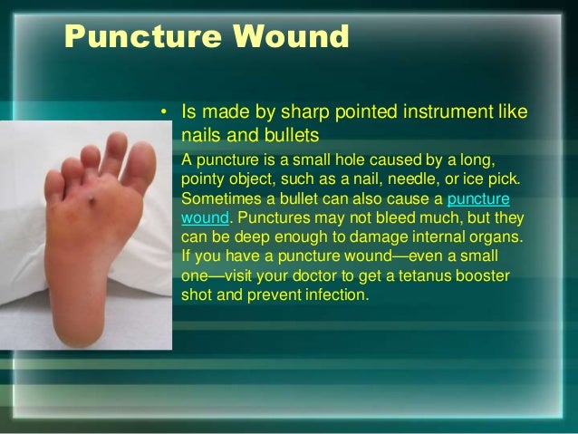 Common Injuries common-injuries