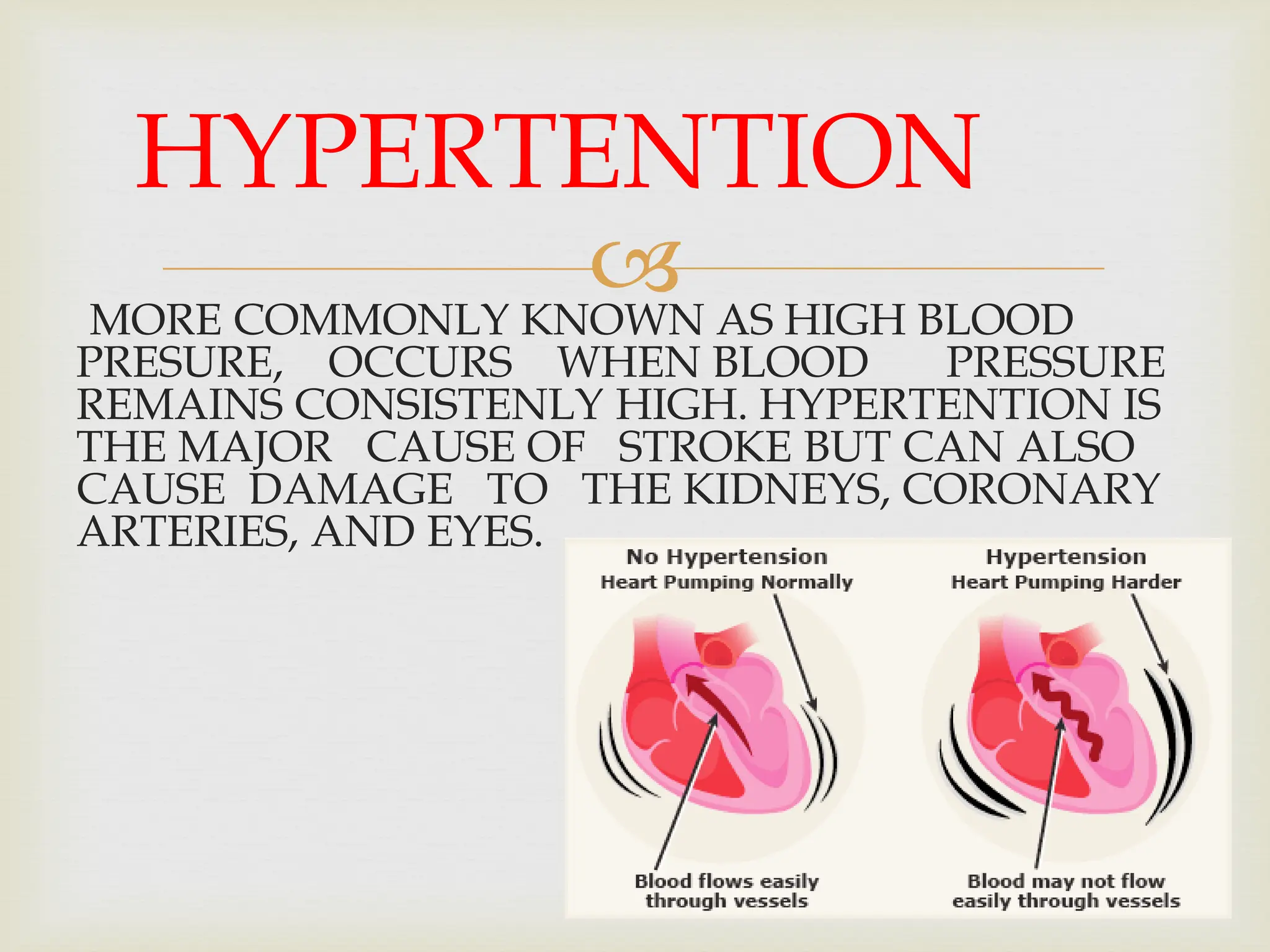 
MORE COMMONLY KNOWN AS HIGH BLOOD
PRESURE, OCCURS WHEN BLOOD PRESSURE
REMAINS CONSISTENLY HIGH. HYPERTENTION IS
THE MAJOR CAUSE OF STROKE BUT CAN ALSO
CAUSE DAMAGE TO THE KIDNEYS, CORONARY
ARTERIES, AND EYES.
HYPERTENTION
 