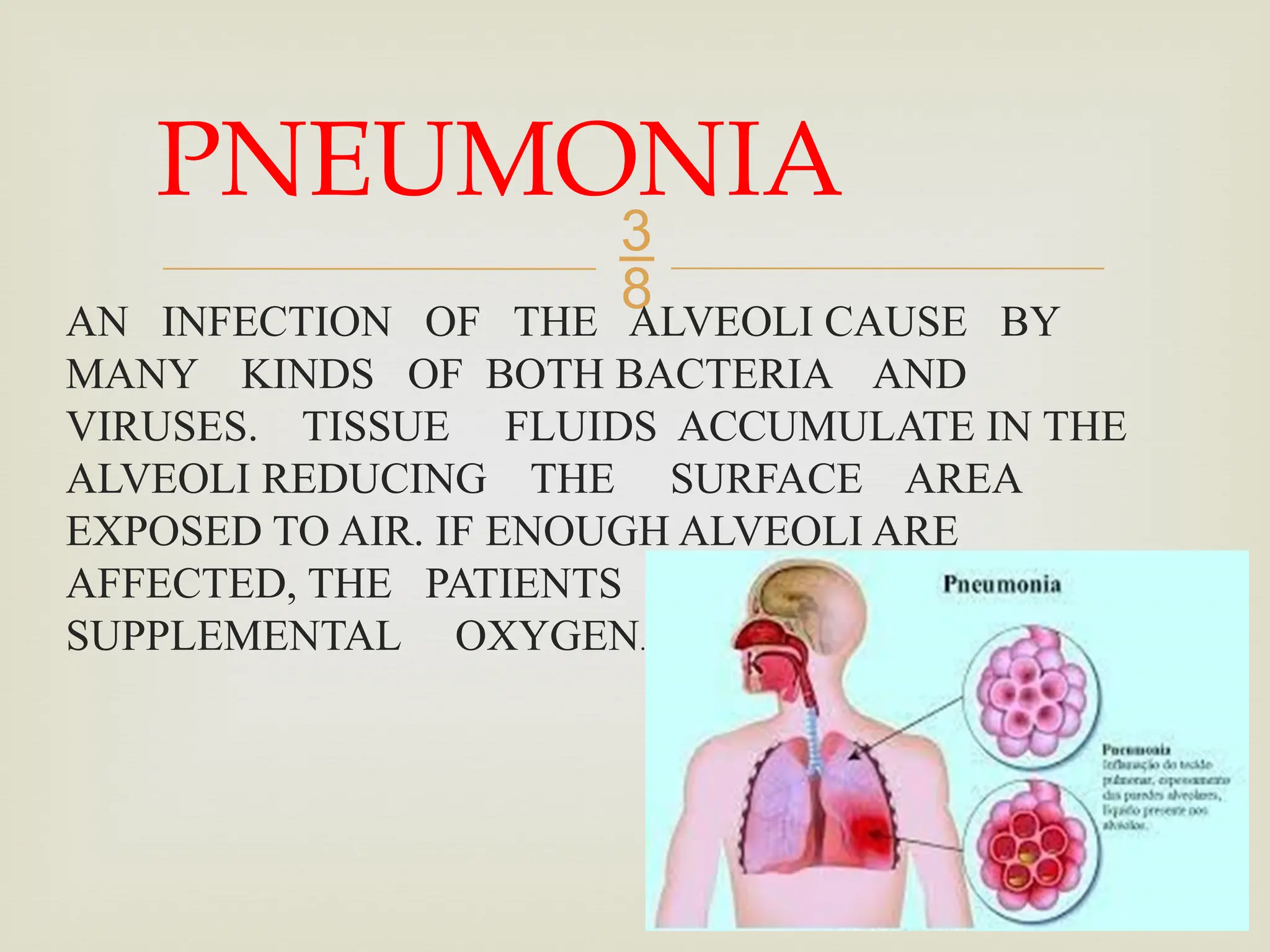 
AN INFECTION OF THE ALVEOLI CAUSE BY
MANY KINDS OF BOTH BACTERIA AND
VIRUSES. TISSUE FLUIDS ACCUMULATE IN THE
ALVEOLI REDUCING THE SURFACE AREA
EXPOSED TO AIR. IF ENOUGH ALVEOLI ARE
AFFECTED, THE PATIENTS MAY NEED
SUPPLEMENTAL OXYGEN.
PNEUMONIA
 