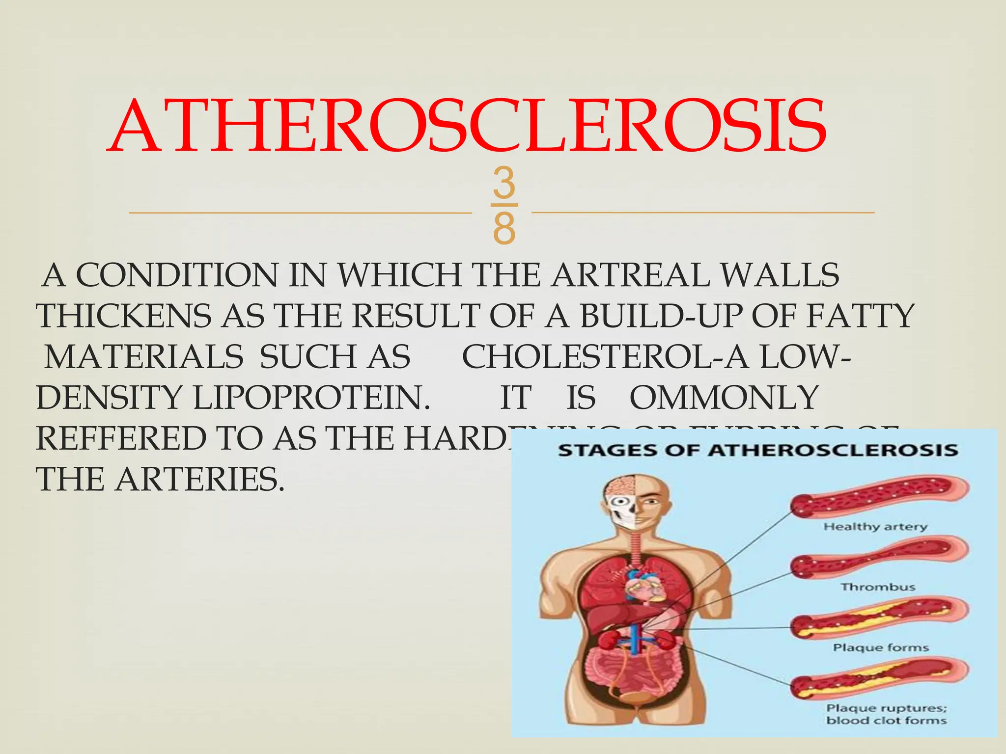 
A CONDITION IN WHICH THE ARTREAL WALLS
THICKENS AS THE RESULT OF A BUILD-UP OF FATTY
MATERIALS SUCH AS CHOLESTEROL-A LOW-
DENSITY LIPOPROTEIN. IT IS OMMONLY
REFFERED TO AS THE HARDENING OR FURRING OF
THE ARTERIES.
ATHEROSCLEROSIS
 