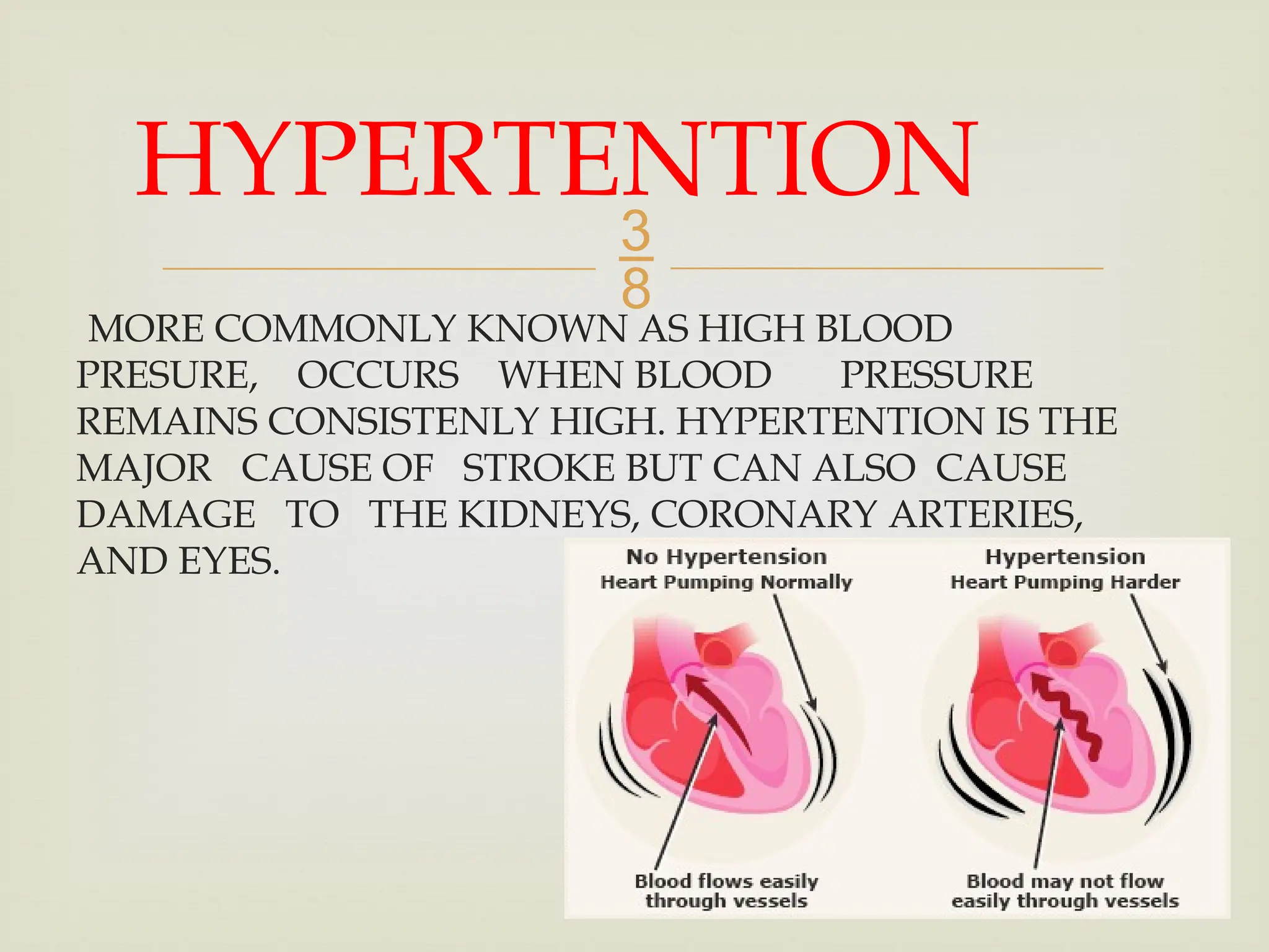 
MORE COMMONLY KNOWN AS HIGH BLOOD
PRESURE, OCCURS WHEN BLOOD PRESSURE
REMAINS CONSISTENLY HIGH. HYPERTENTION IS THE
MAJOR CAUSE OF STROKE BUT CAN ALSO CAUSE
DAMAGE TO THE KIDNEYS, CORONARY ARTERIES,
AND EYES.
HYPERTENTION
 