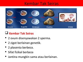 Kembar Tak Seiras




 Kembar Tak Seiras
   2 ovum disenyawakan 2 sperma.
   2 zigot berlainan genetik.
   2 plasenta berbeza.
   Sifat fizikal berbeza
   Jantina mungkin sama atau berlainan.
 