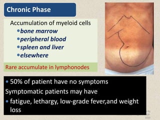 Lesson 4 chronic myeloid leukemia - CML.ppt