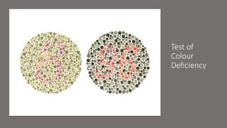 Test of
Colour
Deficiency
 