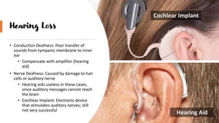 Hearing Loss
• Conduction Deafness: Poor transfer of
sounds from tympanic membrane to inner
ear
• Compensate with amplifier (hearing
aid)
• Nerve Deafness: Caused by damage to hair
cells or auditory nerve
• Hearing aids useless in these cases,
since auditory messages cannot reach
the brain
• Cochlear Implant: Electronic device
that stimulates auditory nerves; still
not very successful
Cochlear Implant
Hearing Aid
 