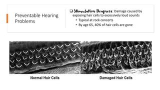 Preventable Hearing
Problems
❑ Stimulation Deafness: Damage caused by
exposing hair cells to excessively loud sounds
• Typical at rock concerts
• By age 65, 40% of hair cells are gone
 
