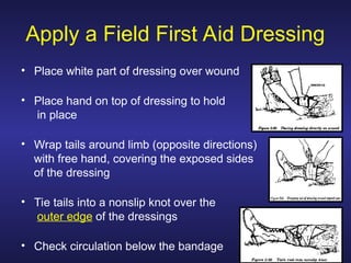 TCCC - Lesson 5 controlling bleeding.ppt