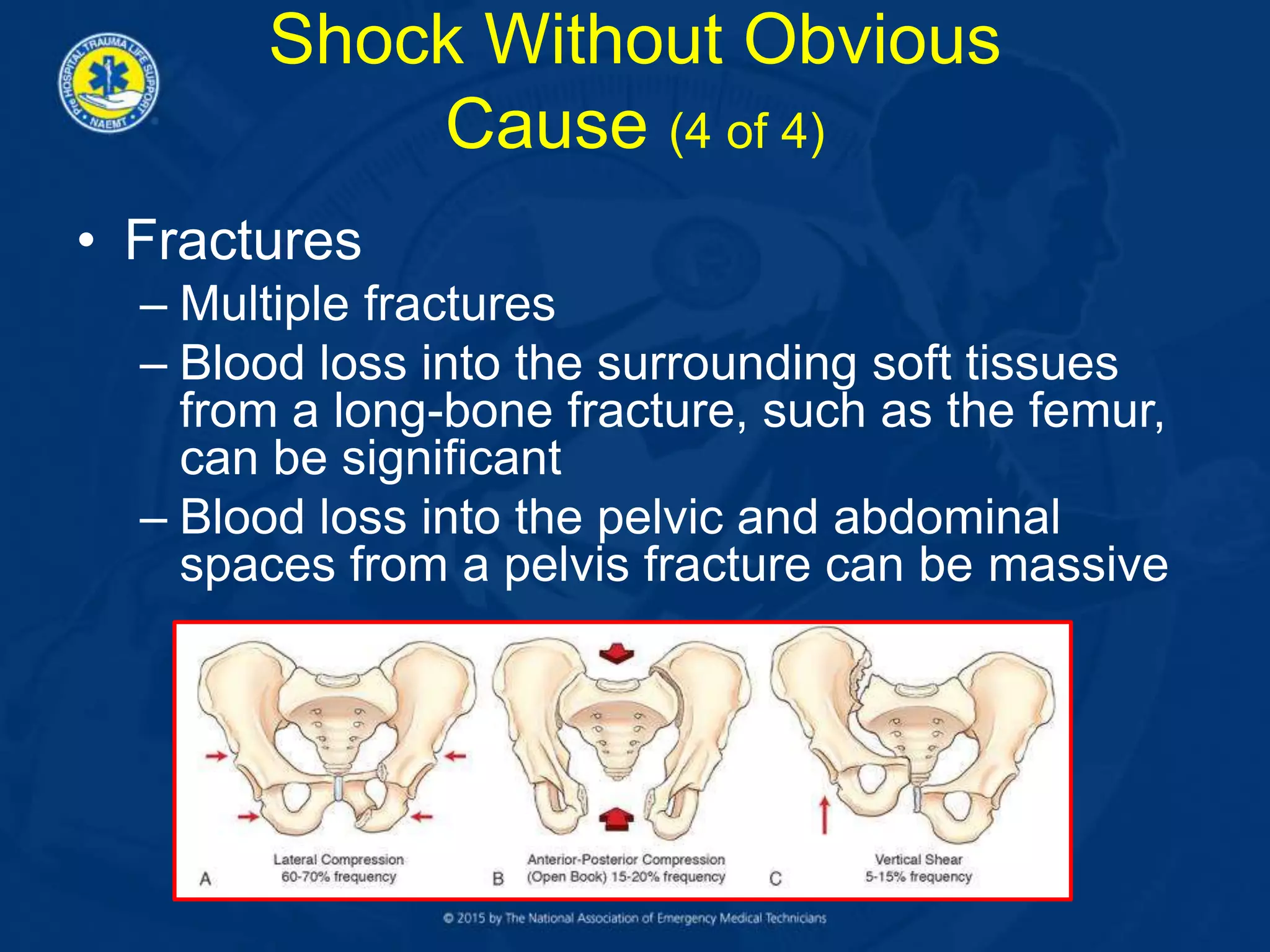 • Fractures
– Multiple fractures
– Blood loss into the surrounding soft tissues
from a long-bone fracture, such as the femur,
can be significant
– Blood loss into the pelvic and abdominal
spaces from a pelvis fracture can be massive
Shock Without Obvious
Cause (4 of 4)
 
