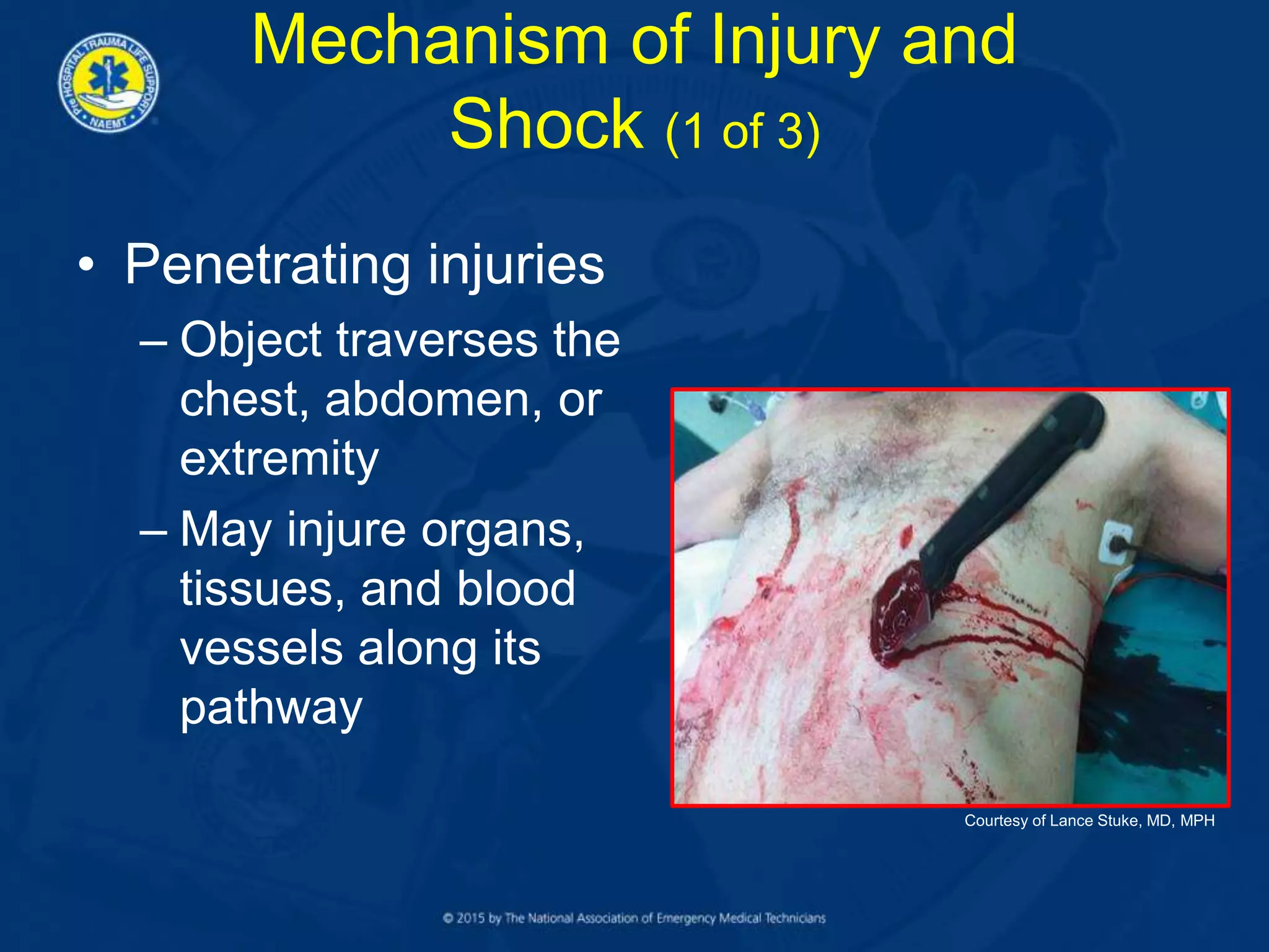 Mechanism of Injury and
Shock (1 of 3)
• Penetrating injuries
– Object traverses the
chest, abdomen, or
extremity
– May injure organs,
tissues, and blood
vessels along its
pathway
Courtesy of Lance Stuke, MD, MPH
 