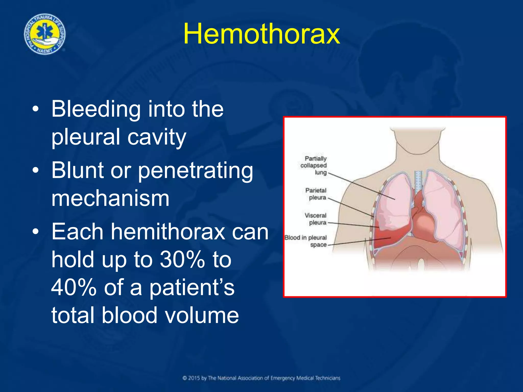 Hemothorax
• Bleeding into the
pleural cavity
• Blunt or penetrating
mechanism
• Each hemithorax can
hold up to 30% to
40% of a patient’s
total blood volume
 