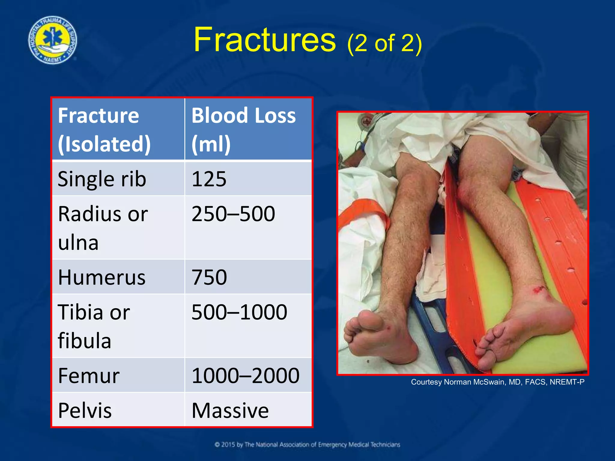 Fractures (2 of 2)
Fracture
(Isolated)
Blood Loss
(ml)
Single rib 125
Radius or
ulna
250–500
Humerus 750
Tibia or
fibula
500–1000
Femur 1000–2000
Pelvis Massive
Courtesy Norman McSwain, MD, FACS, NREMT-P
 