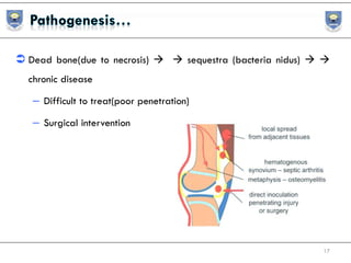  Dead bone(due to necrosis)   sequestra (bacteria nidus)  
chronic disease
– Difficult to treat(poor penetration)
– Surgical intervention
17
 