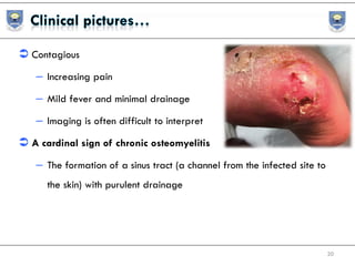  Contagious
– Increasing pain
– Mild fever and minimal drainage
– Imaging is often difficult to interpret
 A cardinal sign of chronic osteomyelitis
– The formation of a sinus tract (a channel from the infected site to
the skin) with purulent drainage
20
 