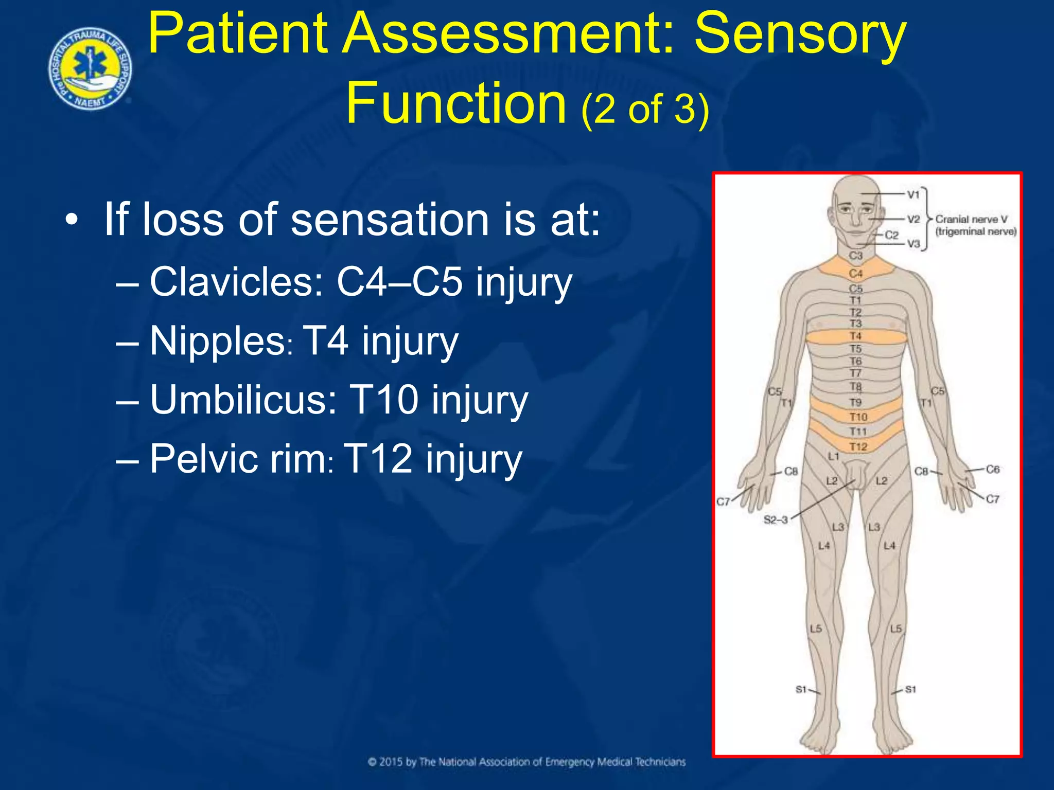 • If loss of sensation is at:
– Clavicles: C4–C5 injury
– Nipples: T4 injury
– Umbilicus: T10 injury
– Pelvic rim: T12 injury
Patient Assessment: Sensory
Function (2 of 3)
 