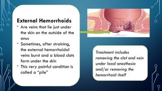 External Haemo Lesson 8 - Diseases in The Digestive System.pptx