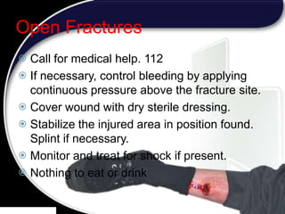 18
Open Fractures
 Call for medical help. 112
 If necessary, control bleeding by applying
continuous pressure above the fracture site.
 Cover wound with dry sterile dressing.
 Stabilize the injured area in position found.
Splint if necessary.
 Monitor and treat for shock if present.
 Nothing to eat or drink
 